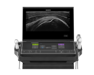 Sonosite ZX is een baanbrekend echografie apparaat